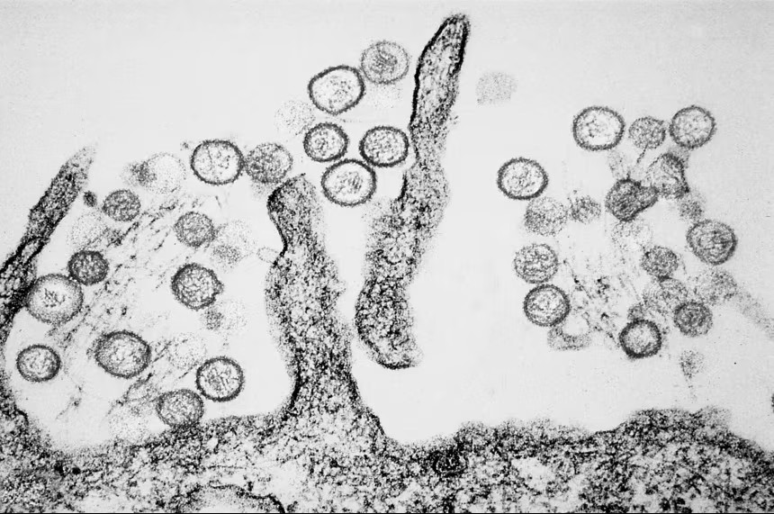 Hantavirus Outbreak Under Investigation After Illnesses on Atlantic Cruise Ship